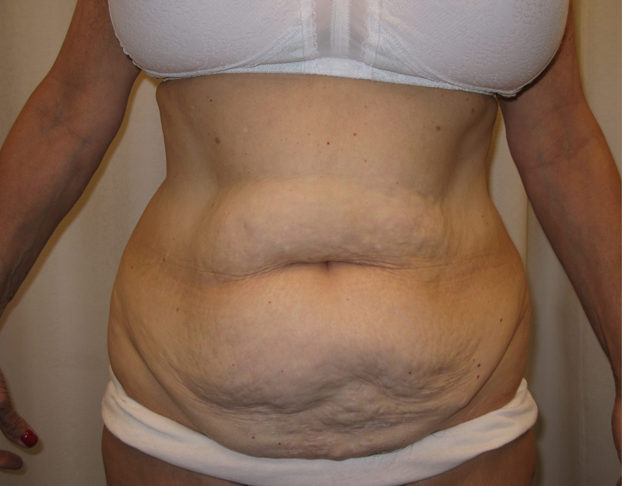 Before Image