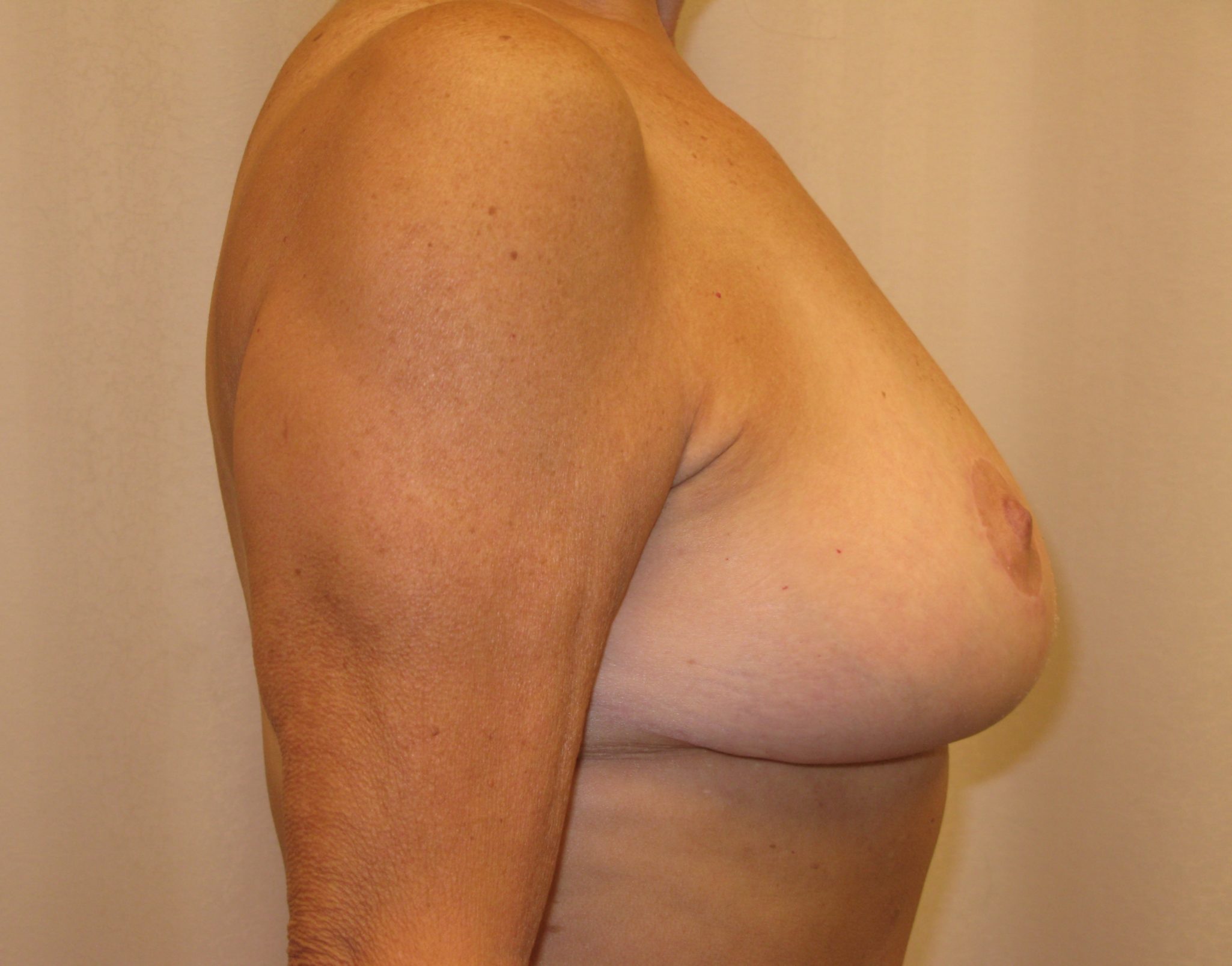 After Image