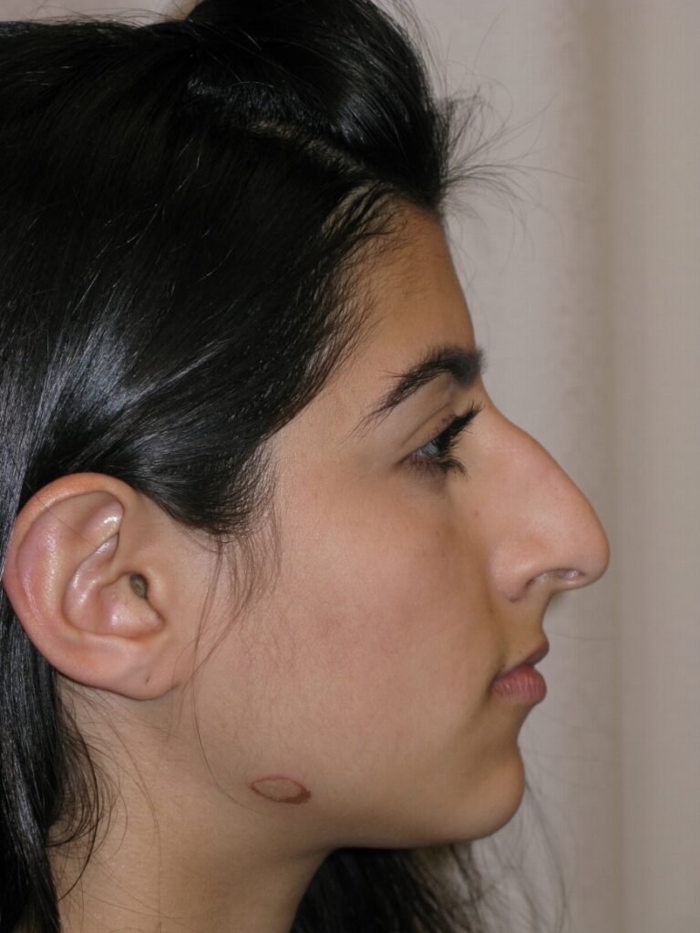 Before Image