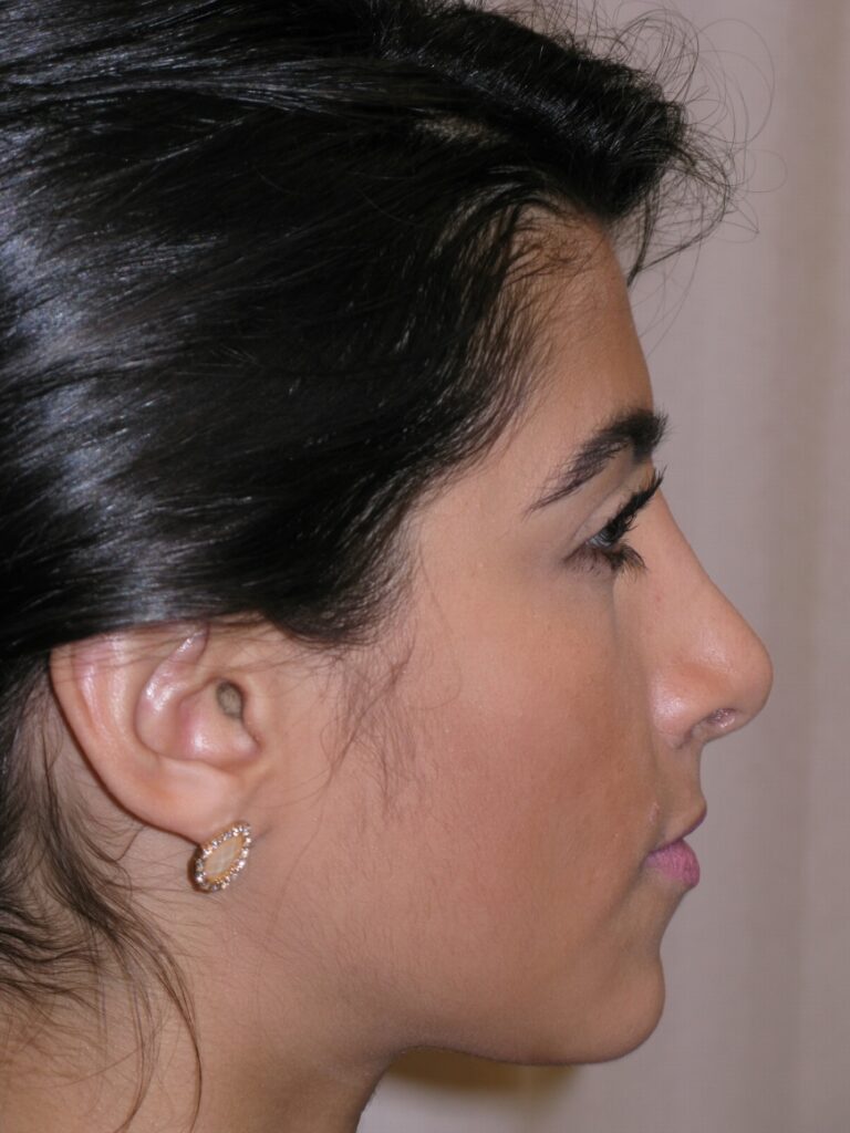 After Image