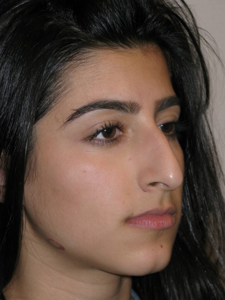 Before Image