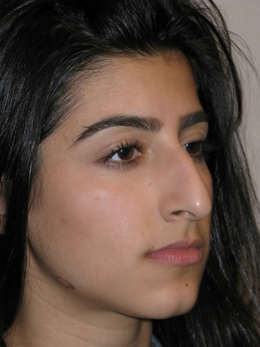 Before Image