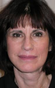 After Image: Facelift & Necklift