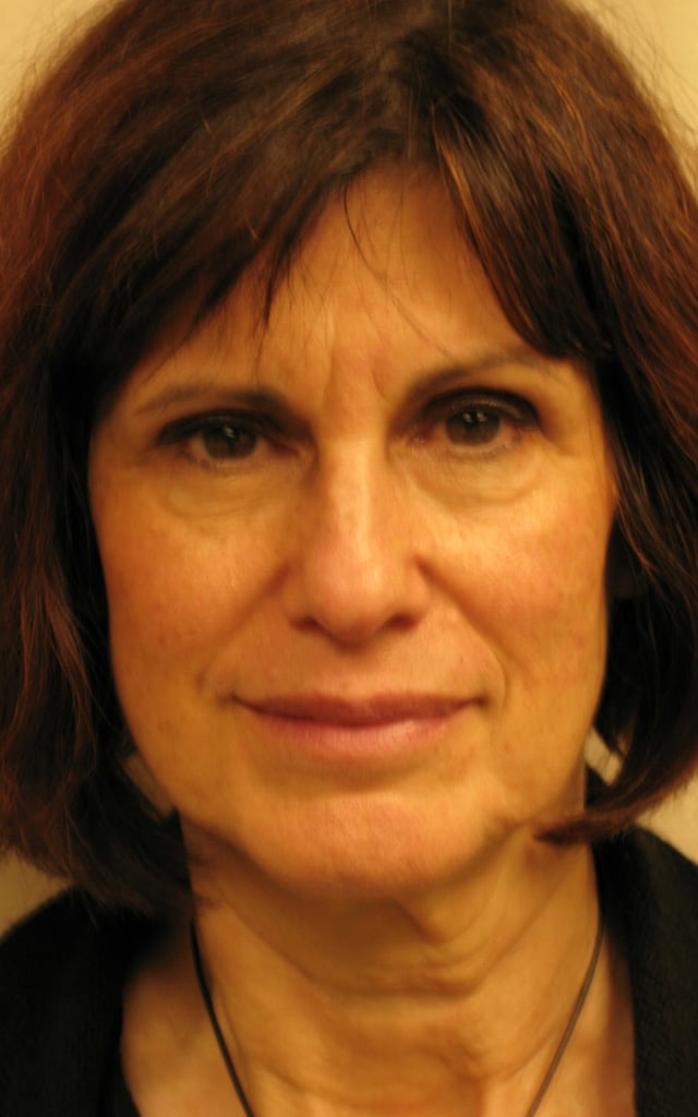 Before Image: Facelift & Necklift - front